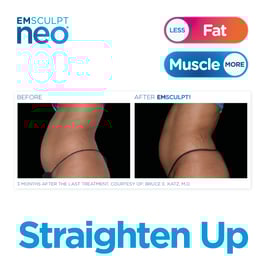 Emsculpt_Neo_POST_September-Calendar_23092021_ENUS100_IGFB
