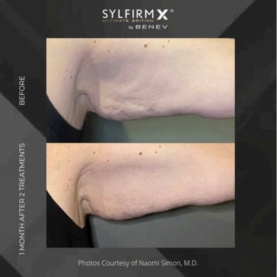 sylfirm-x-3