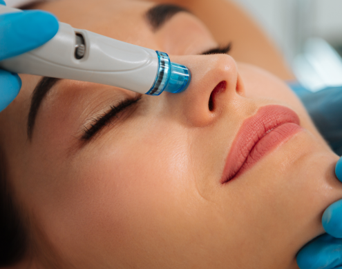 SkinFit Hydrafacial makes maintaining healthy, beautiful skin easy