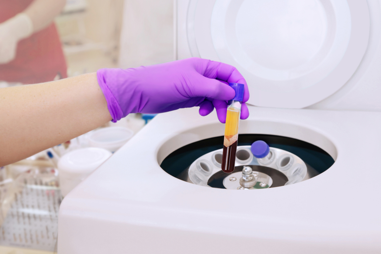 A medical device with its lid open, where it will store sample of blood contained within a vial. The device is a spinning machine used in PRP treatments. There is a hand in a purple glove inserting the vial into the device.